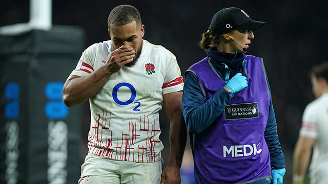 Ollie Lawrence leaves the field after picking up an injury during England v France match in 2023 Six Nations